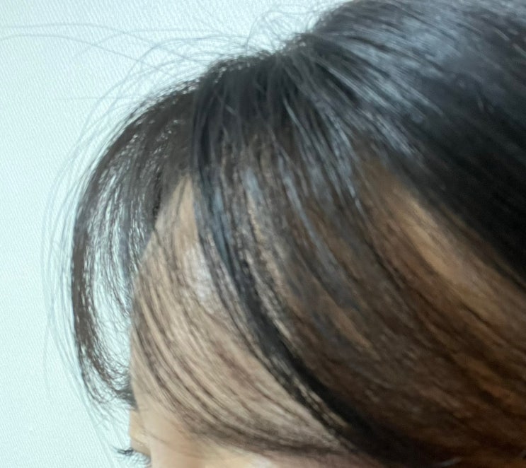  떡지고 기름진 머리 해결템 '해바 퀵 픽스 드라이샴푸'
