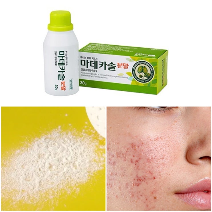  마데카솔 분말 사용법 가격 효능