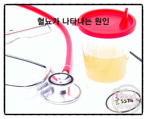  남자소변피 예상되는 질환은