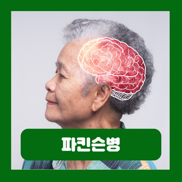  파킨슨병 전조증상 치매 진단 차이 수명 재활 치료 완치 유전