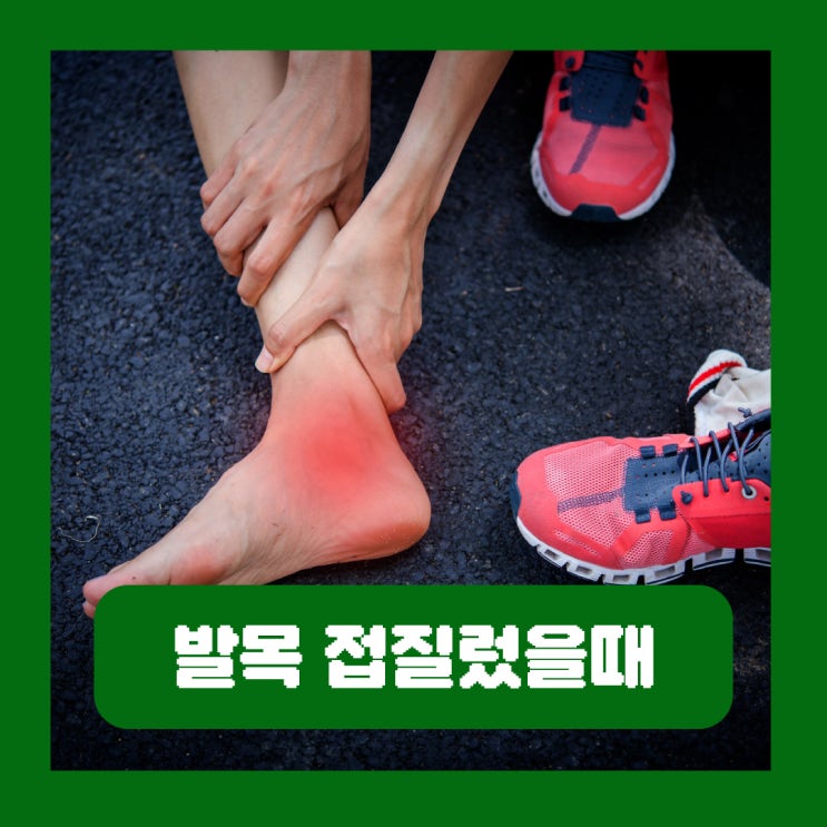  발목 접질렀을때 정형외과 붕대 깁스 한의원 침 찜질 통증 치료
