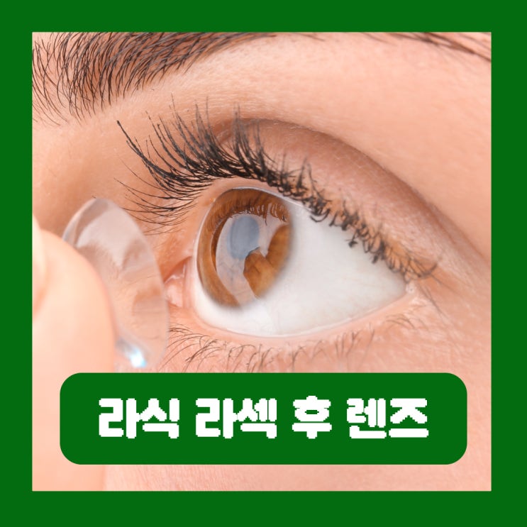  라식 라섹 후 컬러렌즈 서클렌즈 이물감 관리 화장 운동 염색 주의