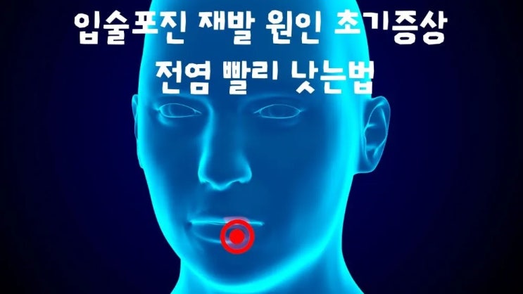  입술포진 재발 원인 초기증상 전염시기 빨리낫는 법
