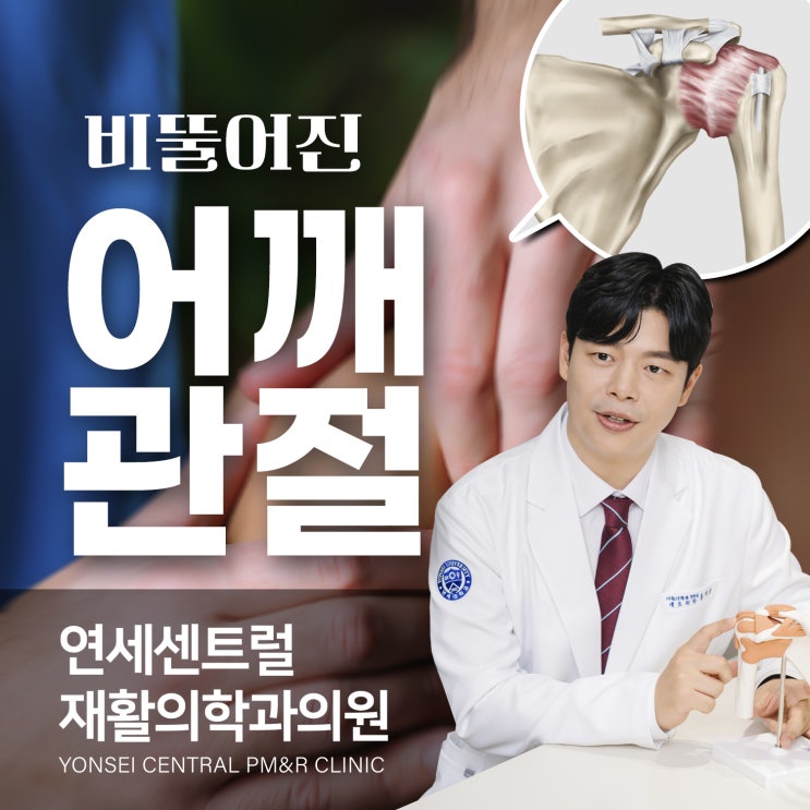  을지로재활의학과, 삐뚤어진 어깨 미리 예방하려면