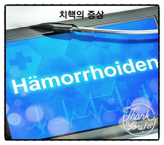  치질 증상 치료법 정리