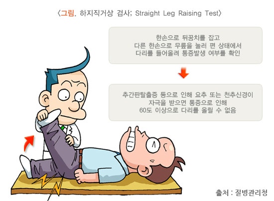 추간판 탈출증(디스크) 원인, 증상, 치료 및 예방법, 좋은 운동 총정리 : 네이버 블로그