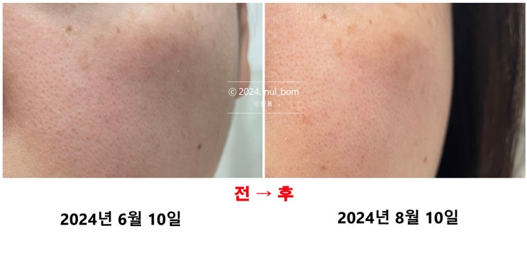  브이티 VT 리들샷 3종 비교 내돈내산 두달사용후기