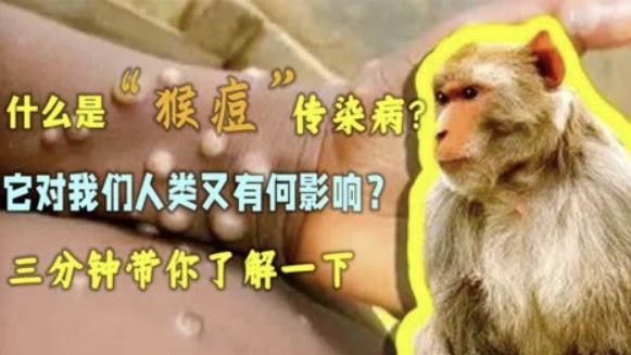  [中경제] 원숭이 두창 ‘최고 경보 수준’, 배터리 원료 수출 금지 등