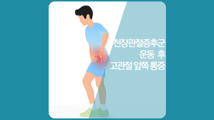  천장관절증후군 운동후 고관절 앞쪽 통증