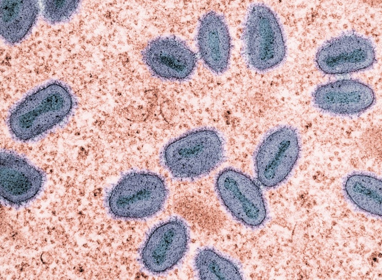  엠폭스(MPOX) 알아보기. 증상부터 예방까지