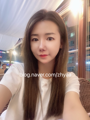  수원피부과 심부볼 리프팅 텐써마 300샷 후기! 효과 굿
