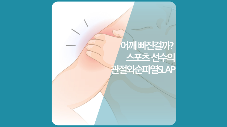  인천 미추홀 재활병원(송도, 청라, 부평) 어깨통증 빠짐 증상 관절와순파열(손상) SLAP