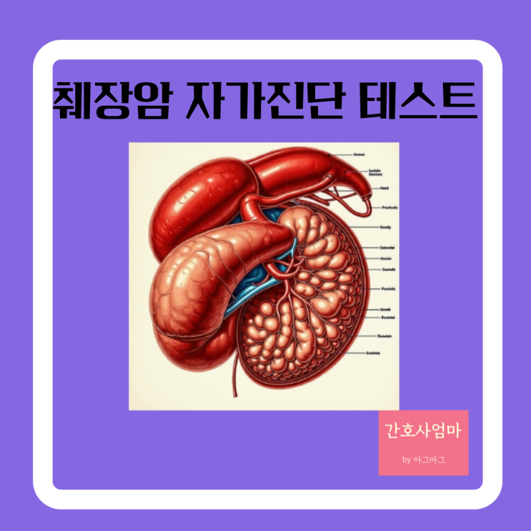  췌장암 증상 자가진단 테스트 좋은음식 나쁜음식
