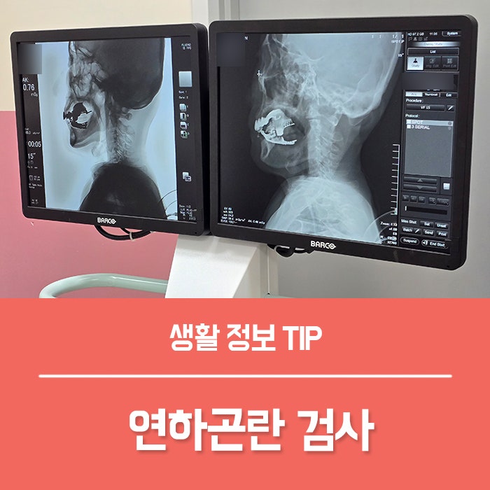  연하곤란 증상, 노인 삼킴장애(연하장애) 검사 총정리!