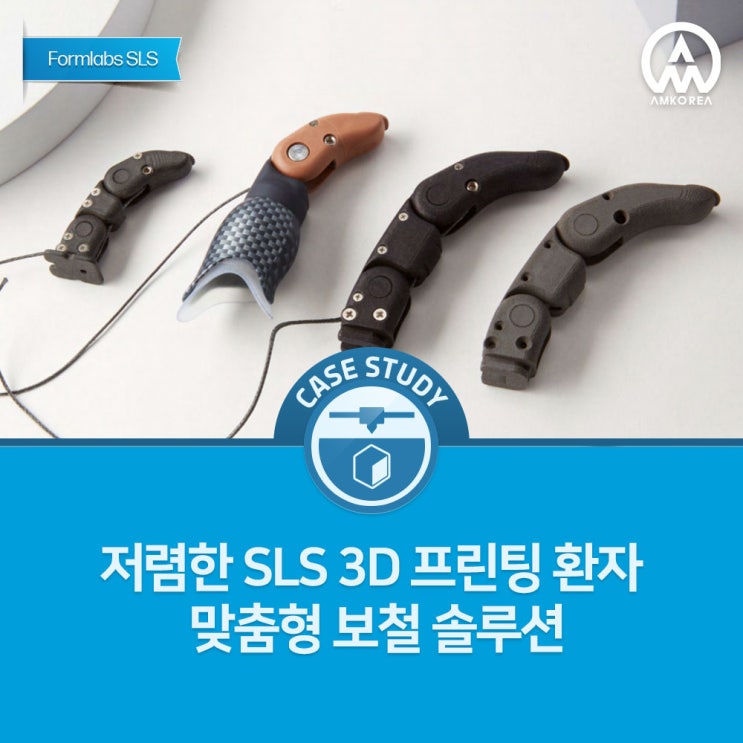  [Formlabs SLS] 저렴한 SLS 3D 프린팅 환자 맞춤형 보철 솔루션