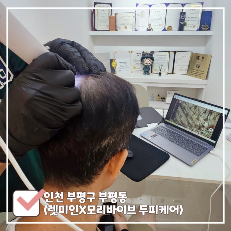  부평 두피관리샵 50대 탈모 남성이 다녀온 리얼 후기｜렛미인X모리바이브 두피케어 부평점