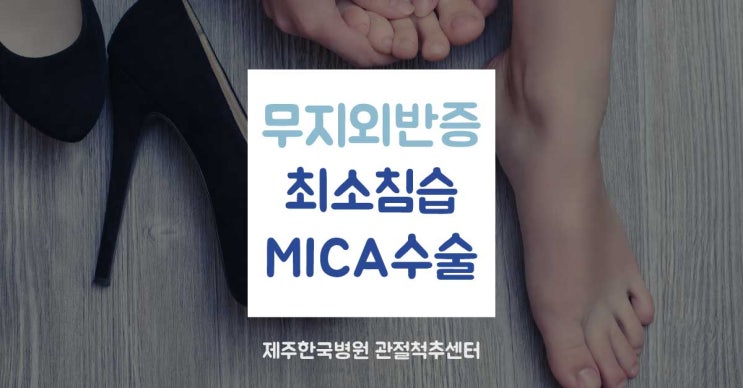  제주한국병원 관절척추센터, 무지외반증 최소침습 수술 MICA(미카) 제주 최초 도입!!