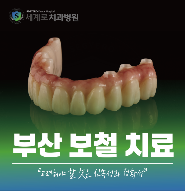  부산 보철 치료 신속 정확성이 중요