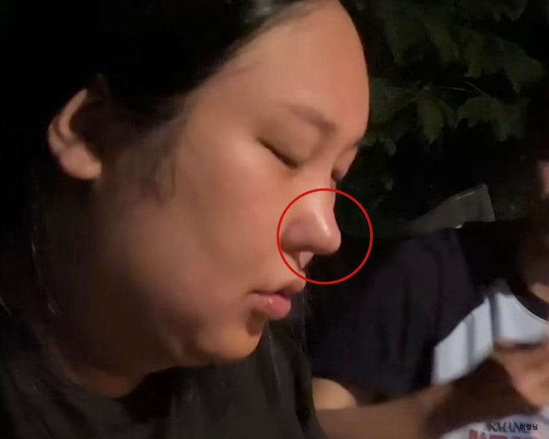 풍자 코성형 과사 변천사로 알아보는 코수술 부작용은?