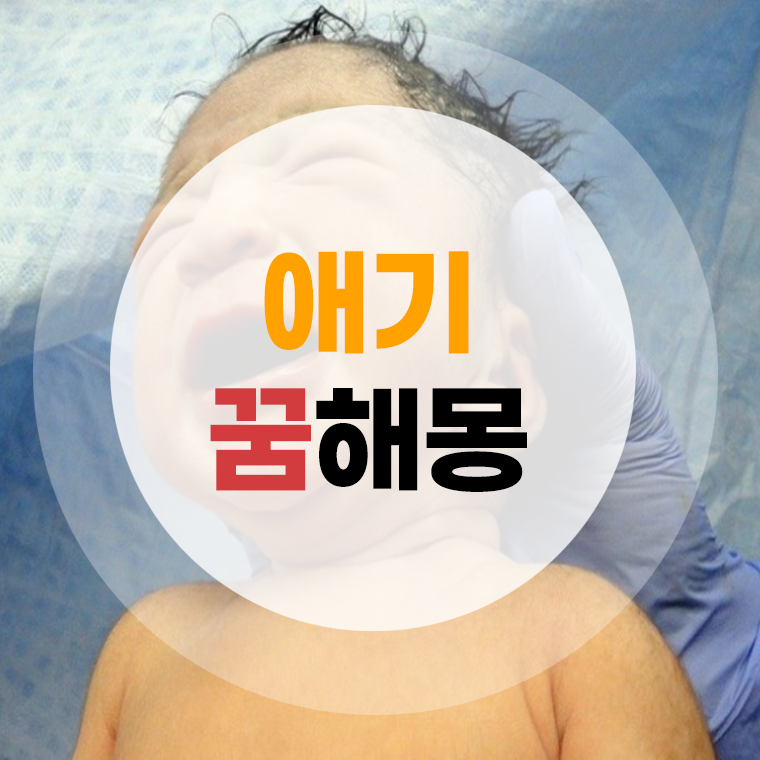 애기낳는꿈 해몽 출산하는꿈 딸낳는꿈 아들낳는꿈 쌍둥이낳는꿈 풀이