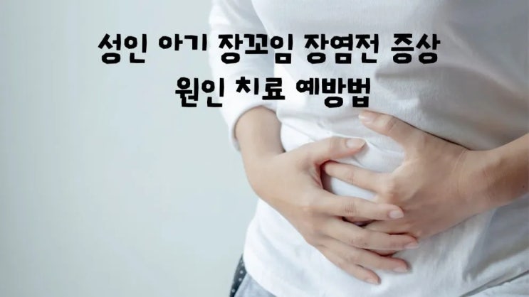  장꼬임 증상 성인 아기 원인 장염전 치료 예방법