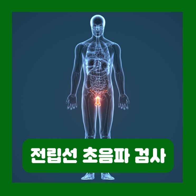  전립선 초음파 검사비용 준비 비대증 전립선염 암 증상 치료