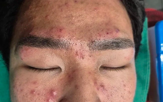 지성피부 남자들을 위한 전주눈썹문신 :오래 지속되는 비결은?