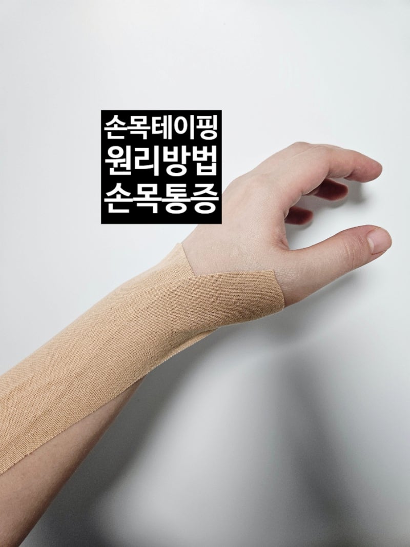 손목통증 테이핑 방법 물리치료 정형외과 통증의학과 어디