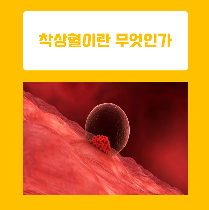  임신초기 착상혈 시기와 의미