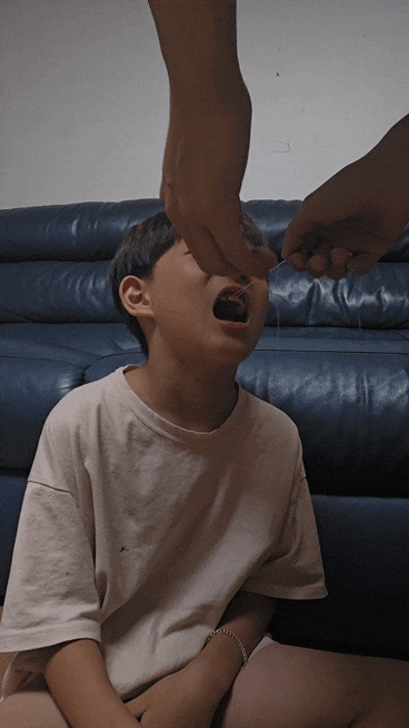  집에서 이빨 빼기 유치보관함