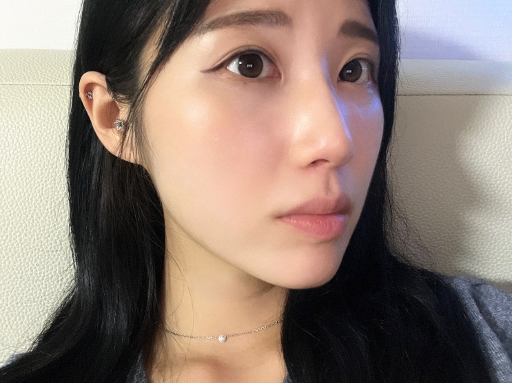  홍대 쥬베룩볼륨 팔자주름 1회차 솔직후기
