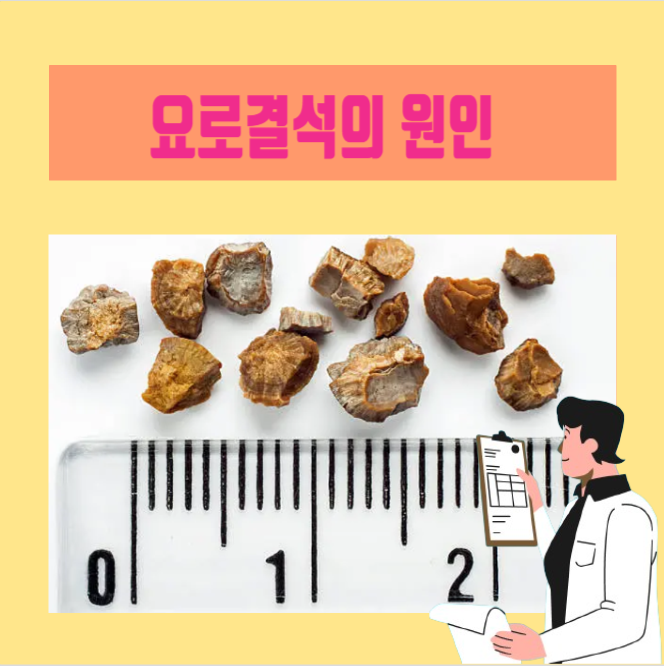  [이학박사] 요로결석 증상, 치료 및 도움되는 음식
