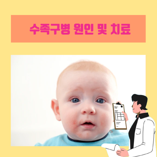  [이학박사] 아이들 사이에 유행중인 수족구병(hand foot and mouth disease) 증상과 원인