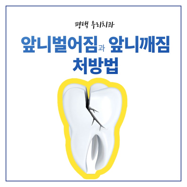  평택 앞니벌어짐 앞니깨짐 치료로 뭐가 적합한가?