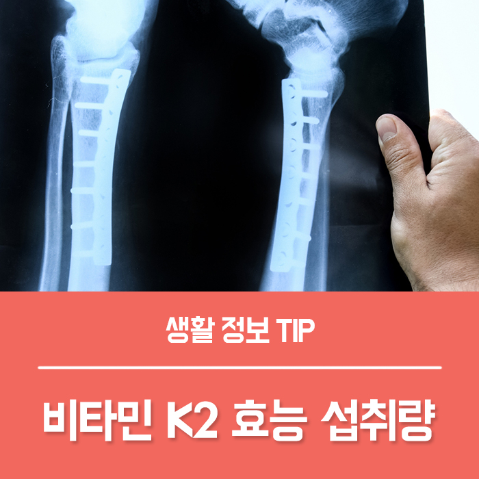  비타민K2 식품 낫토 효능, 메나퀴논 비타민K2 섭취량은?