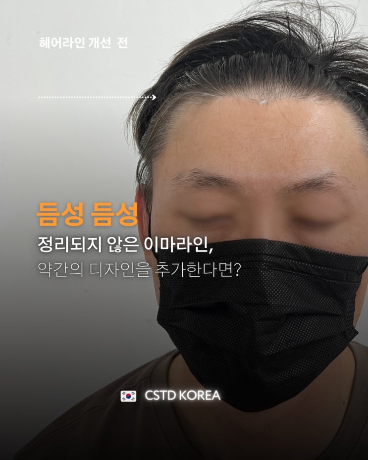  두피문신 후 반드시 지켜야 할 3가지 관리사항