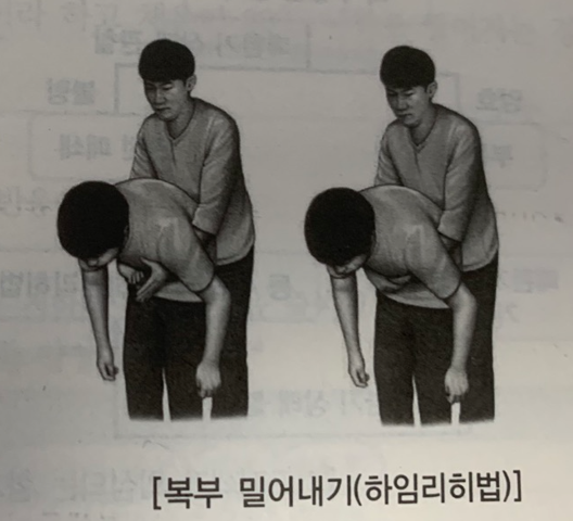  기도 막혔을 때, 이물에 의한 기도 폐쇄 응급처치법, 하임리히법(Feat. 연령대별)