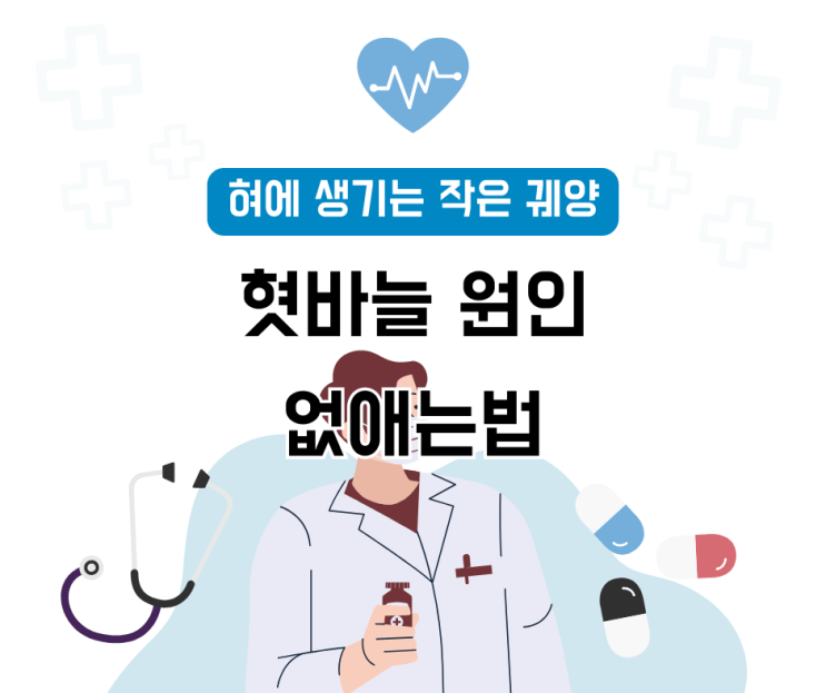  ‘혀에 생기는 작은 궤양’ 혓바늘원인과 없애는법(혓바늘약)