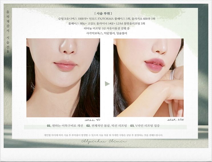 목동피부과 리프팅 화수목 특가 EVENT