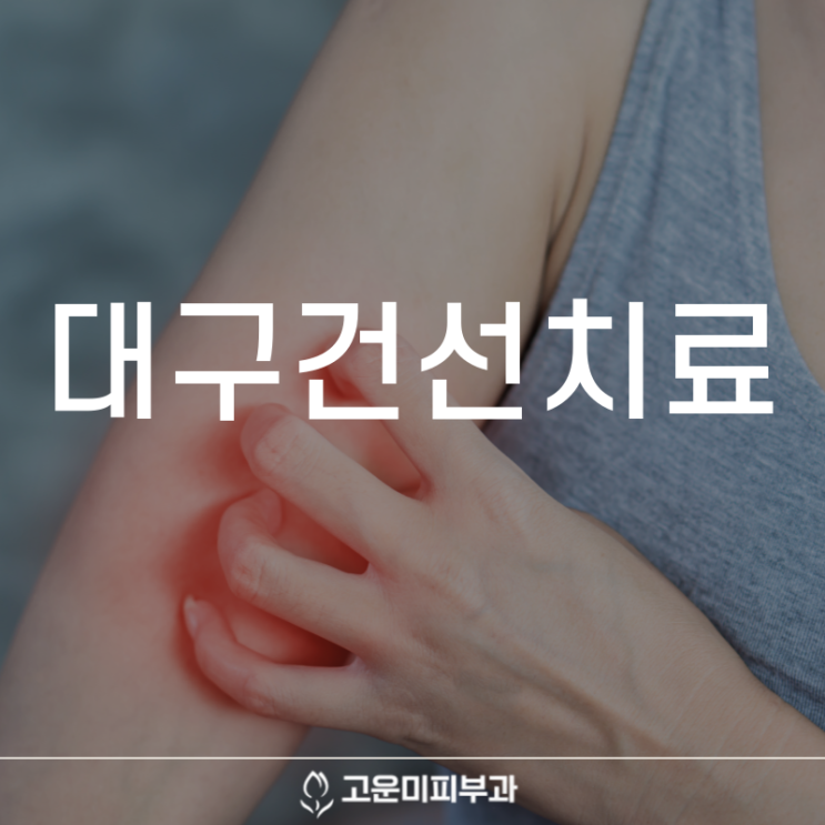  대구건선치료 피부에 홍반과 인설이 동반되는 질환 건선은 재발이 자주 되어 적절한 치료와 관리가 필요합니다