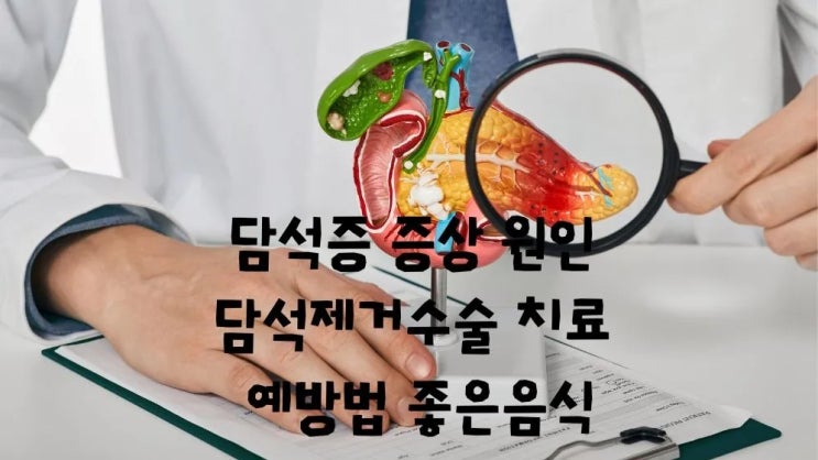  담석증 증상 원인 치료 담석제거수술 예방 좋은음식
