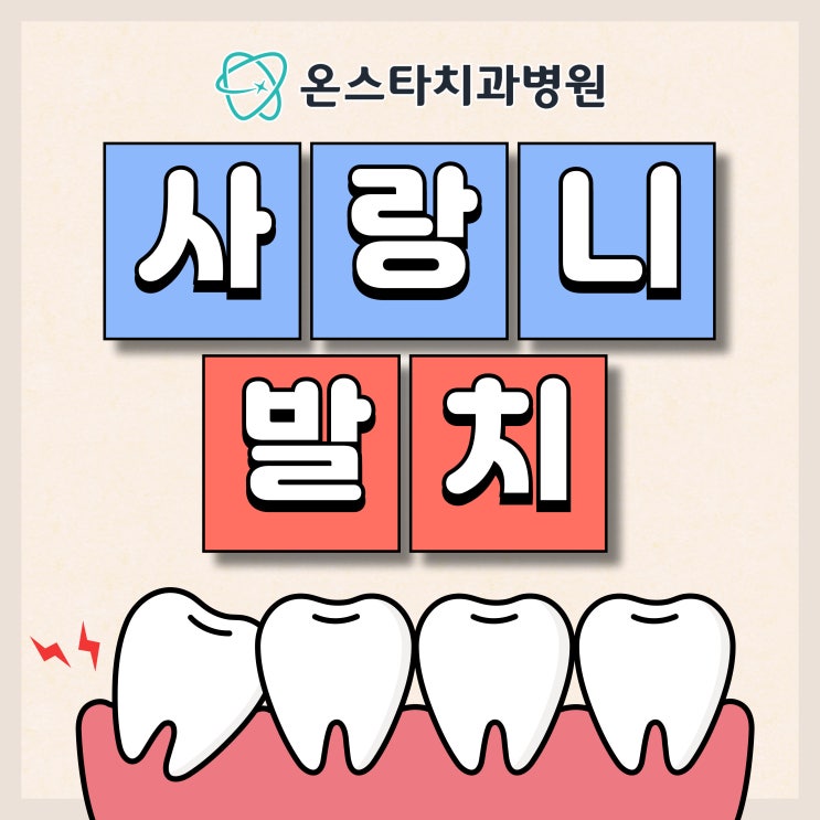 대전 사랑니 발치 필요한 경우와 부작용