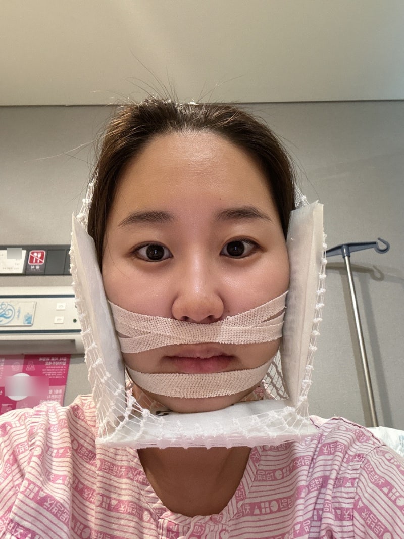나의 양악수술 후기7 :: 양악 핀제거 수술 하고 왔다!!!!!