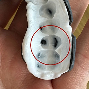 복싱 마우스피스 제작, 오프로 커스텀핏 성형 후기 / 숨쉬기 편한 OPRO 마우스가드