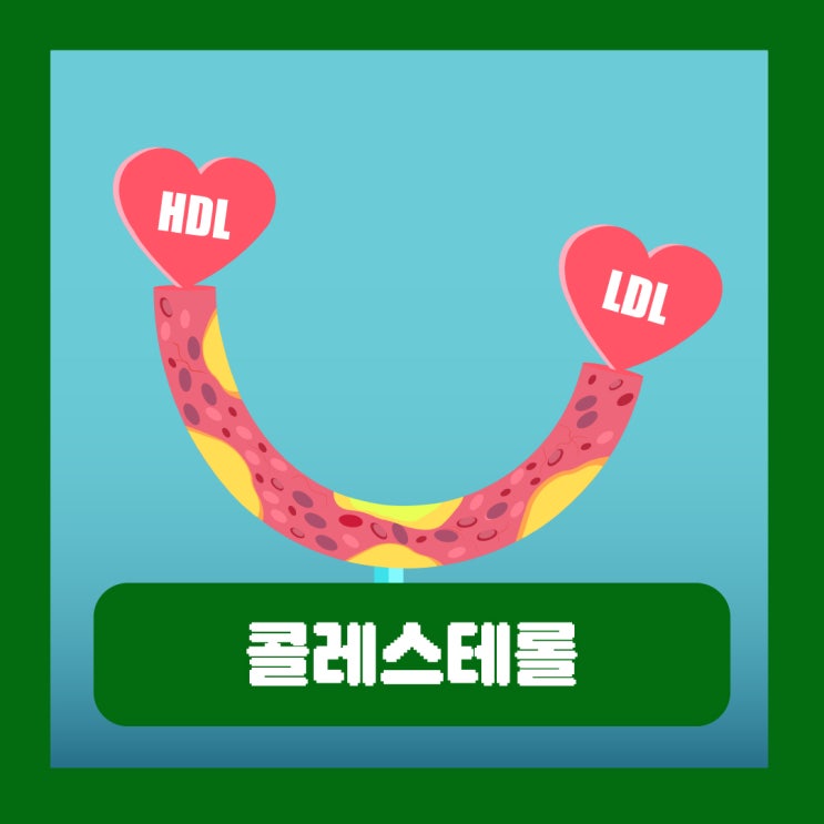  총콜레스테롤 수치 250 낮추기 HDL LDL 콜레스테롤 정상수치