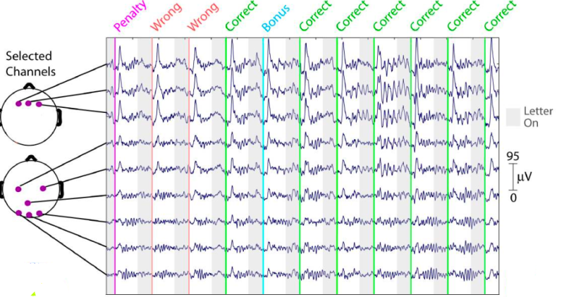 EEG(Electroencephalogram) 뇌파 검사 뜻, 차이 : 네이버 블로그