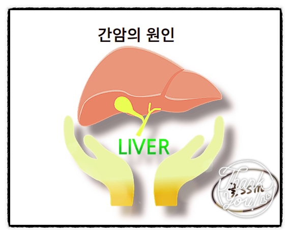  간암 복수 초기 증상과 치료