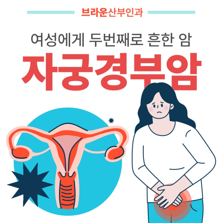  브라운산부인과 자궁경부암 조기발견을 위한 예방법