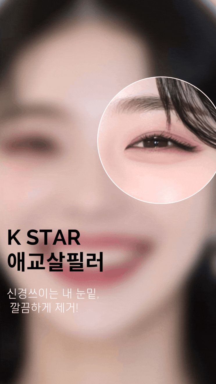  광주애교살필러로 눈밑 그늘 제거할 수 있다면