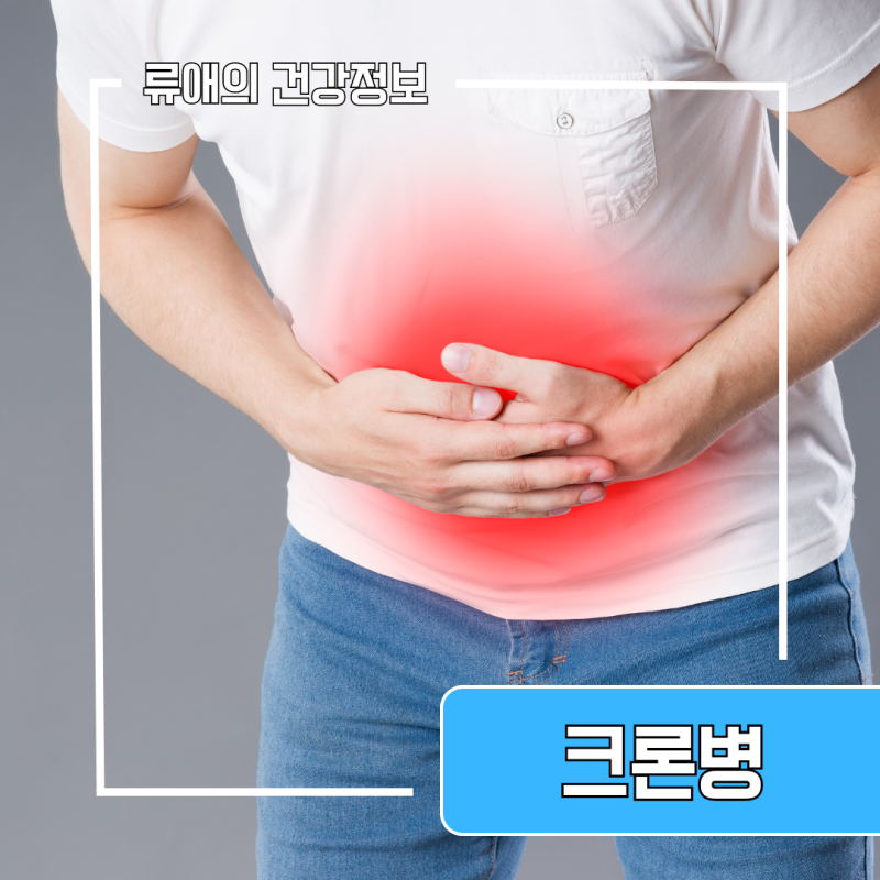 크론병 초기증상 원인 완치 여부 : 소아 크론병 증상 병원